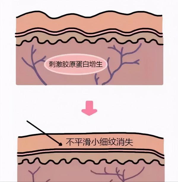 入門級醫美專案指南!美容院不告訴你的,這篇全都有 入門級醫美專案指南!美容院不告訴你的,這篇全都有