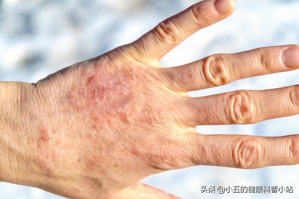 便宜的谷維素是治療失眠、高血脂的良藥,服用時注意4個問題 便宜的谷維素是治療失眠、高血脂的良藥,服用時注意4個問題