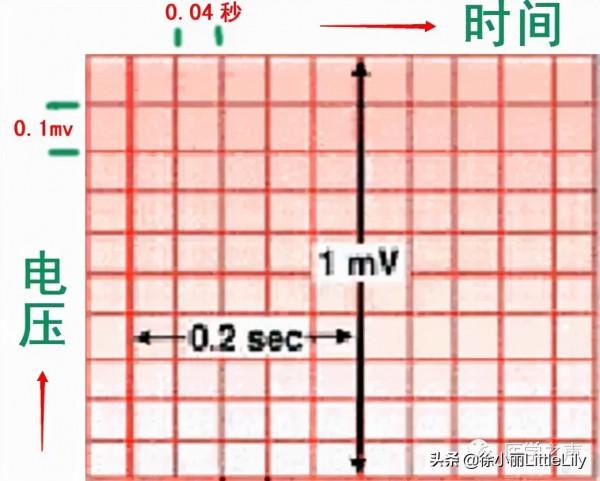 這樣教你看心電圖,沒有理由看不懂 這樣教你看心電圖,沒有理由看不懂
