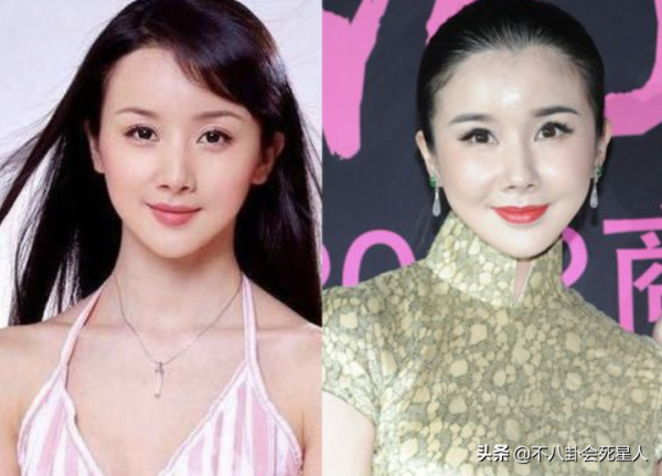 那些亂整鼻子的女明星還好嗎？後遺症一大堆，楊冪金晨都開始崩了