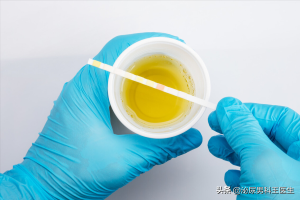 有泡沫尿就是腎臟有問題嗎? 有泡沫尿就是腎臟有問題嗎?