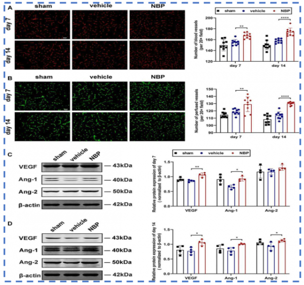 《Frontiers in Pharmacology》:丁苯酞促進TIA模型小鼠血管新生 《Frontiers in Pharmacology》:丁苯酞促進TIA模型小鼠血管新生