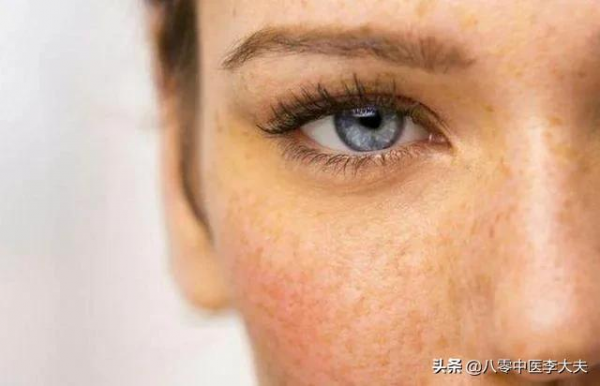 色斑,老年斑,嘴唇黑,胸口刺痛疼?血府逐瘀,活血化瘀,氣血旺 色斑,老年斑,嘴唇黑,胸口刺痛疼?血府逐瘀,活血化瘀,氣血旺