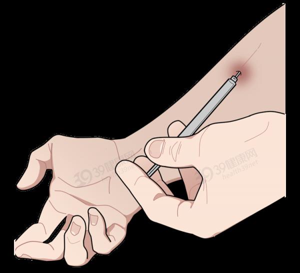 如何分辨一個人是否吸毒?看完這些吸毒者的典型症狀,心裡發毛 如何分辨一個人是否吸毒?看完這些吸毒者的典型症狀,心裡發毛