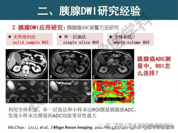 體部DWI共識及胰腺DWI研究經驗介紹