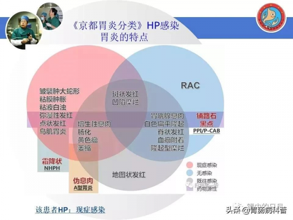 早期胃癌——內鏡診治流程