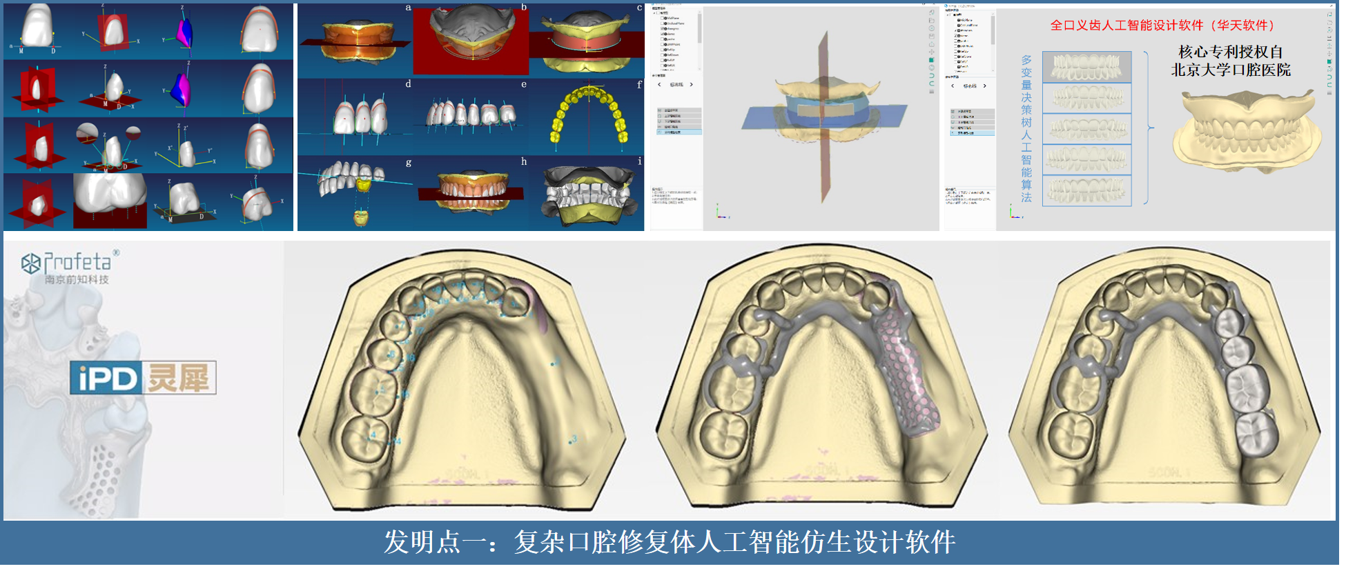 為了患者“好牙口”，他們用人工智慧、3D列印與仿生材料“重塑”牙齒