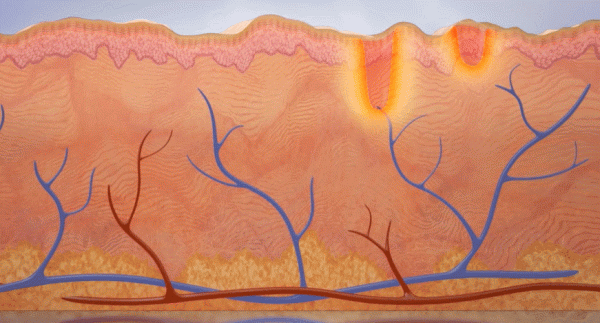 毛孔粗大怎麼辦?超全指南解決你的毛孔問題 毛孔粗大怎麼辦?超全指南解決你的毛孔問題