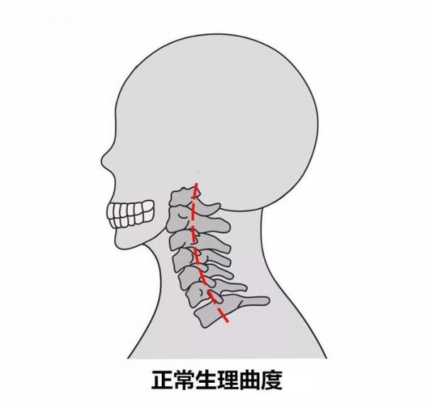一個枕頭解救頸椎病，還有比它價效比更高的方法嗎？幾張圖說明白