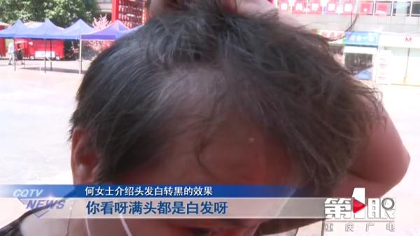 女子花4萬做“白髮轉黑”,結果治療就是拔白頭髮,網友:我媽差點嘗試了 女子花4萬做“白髮轉黑”,結果治療就是拔白頭髮,網友:我媽差點嘗試了