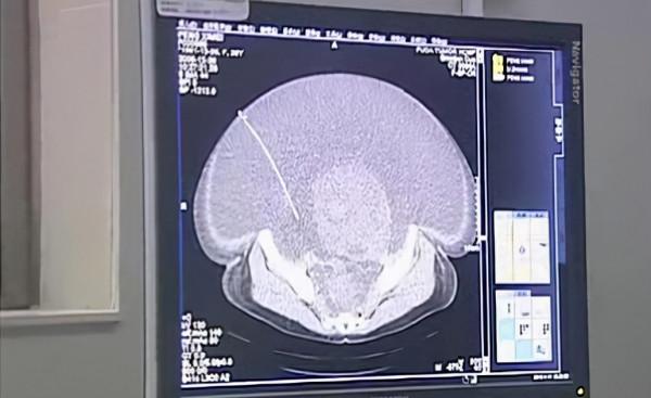 女子懷胎一年未生產遭到丈夫拋棄,身無分文的她挺著50斤巨肚流浪 女子懷胎一年未生產遭到丈夫拋棄,身無分文的她挺著50斤巨肚流浪