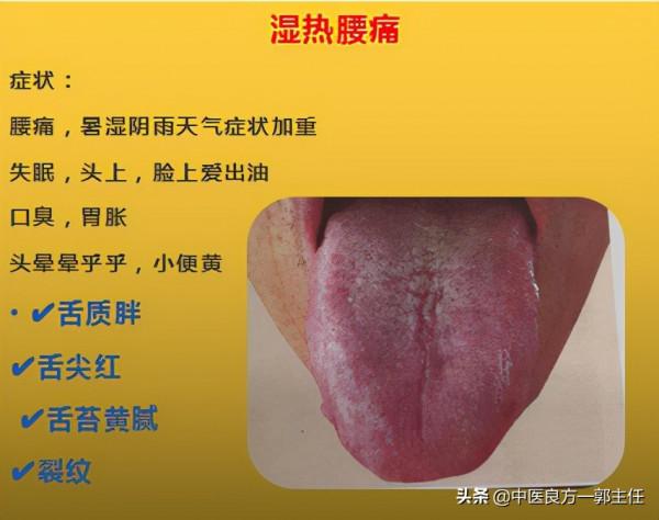 12種“熱”藏於體內,反應的舌象、症狀各不相同,自查便知 12種“熱”藏於體內,反應的舌象、症狀各不相同,自查便知