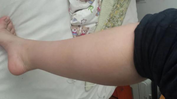 身體的這4個部位肥胖，或與經絡不暢有關，建議先疏通經絡再減肥