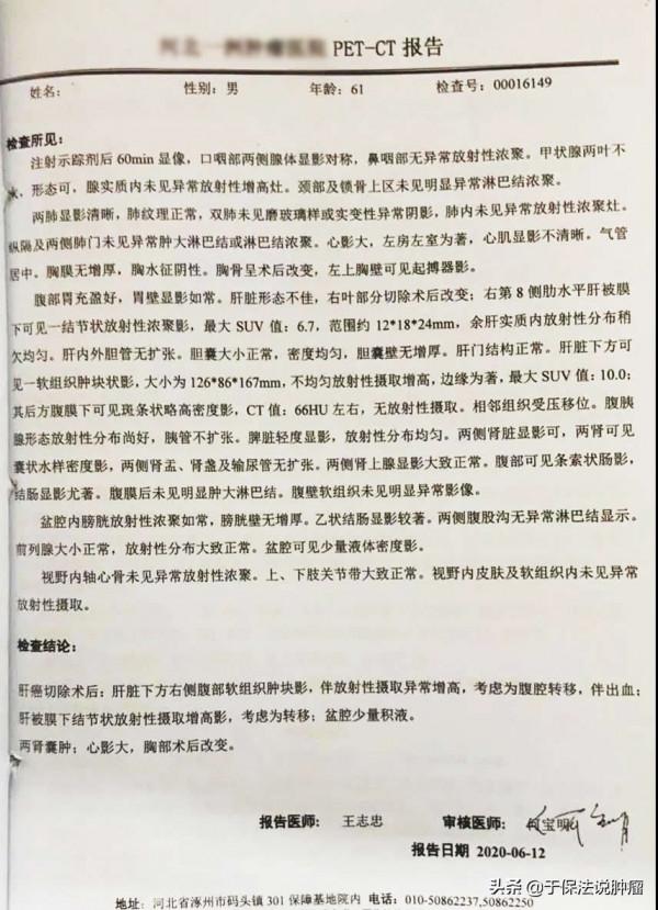 丙肝後確診肝癌，術後一年復發，後經緩釋庫治療過程分享