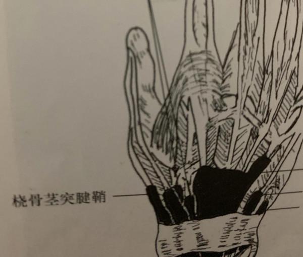 啥是“媽媽手”？疼，怎麼辦？