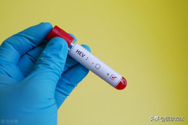 患上乙肝，總感覺面板瘙癢？3個因素，你是否注意到