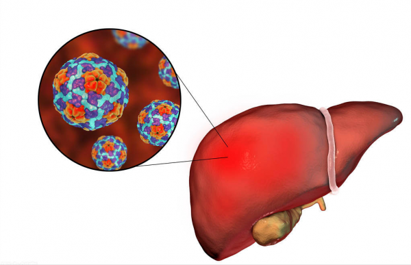 2箇中成藥，改善肝膽溼熱，保肝降酶退黃，增強抗HBV，提高轉陰率