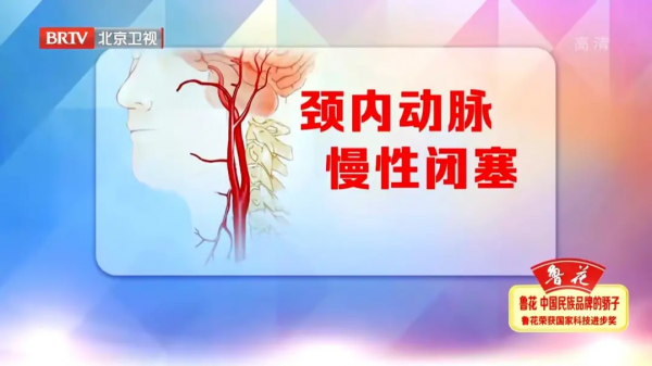 頭暈頭沉、反應力下降？可能是頸動脈出了大問題！2個檢查早發現