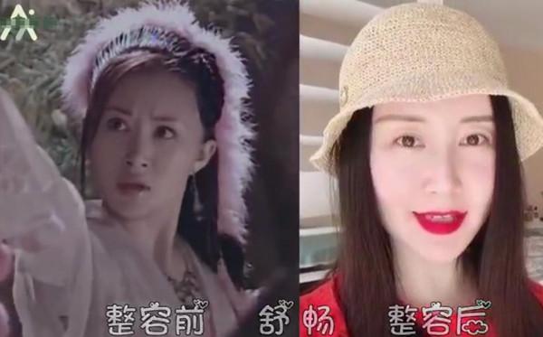 10位“整容過度”的女星：舒暢張檬畫蛇添足，黃夏惠變“鞋拔臉”