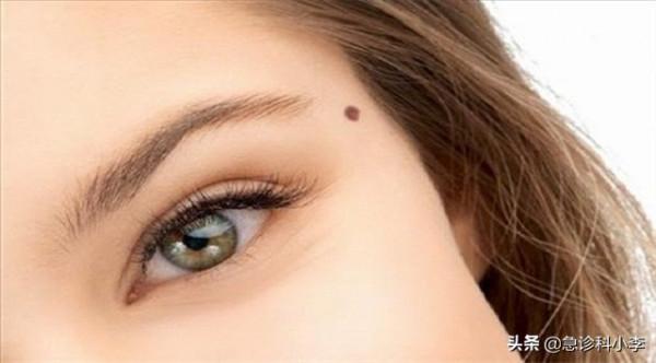 身上出現很多小紅點，不痛不癢是怎麼回事？聽聽醫生怎麼說