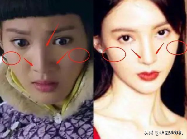 明星大型“翻車”現場，她們是如何整容變毀容的