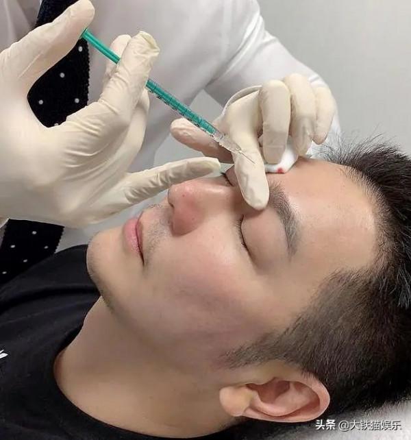 臉沒恢復就先別出來撈金了，腫脹、僵硬感溢位螢幕，顏值崩了一地