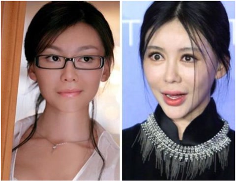 被整容毀了的7位明星，雖各有各的苦衷，卻都美麗盡失、事業滑坡