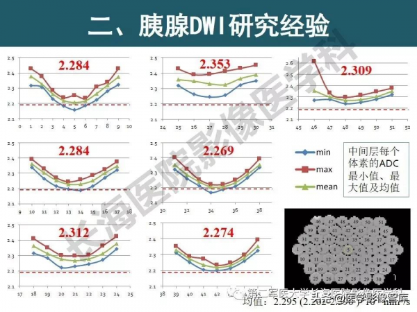 體部DWI共識及胰腺DWI研究經驗介紹