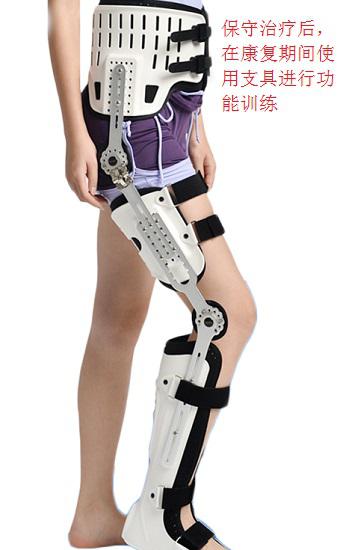 股骨頸骨折後的治療方案