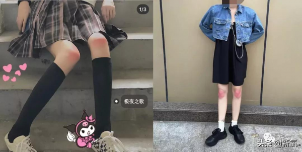 貴圈所謂的純欲天花板,就是在關節上打腮紅嗎? 貴圈所謂的純欲天花板,就是在關節上打腮紅嗎?