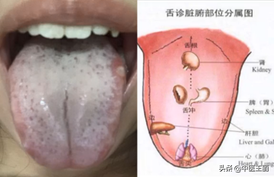 從舌頭看健康：今天和大家分析四個典型的舌診型別，每日舌診分析