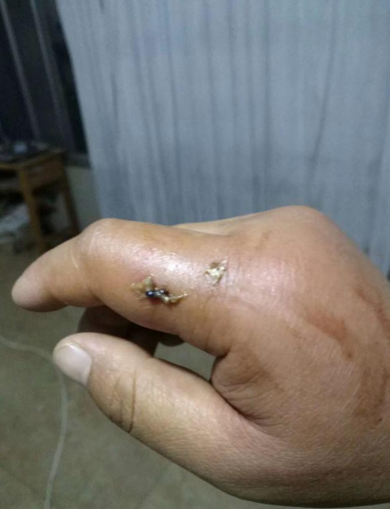 被馬蜂蟄了,應該怎麼處理?這回告訴你答案 被馬蜂蟄了,應該怎麼處理?這回告訴你答案