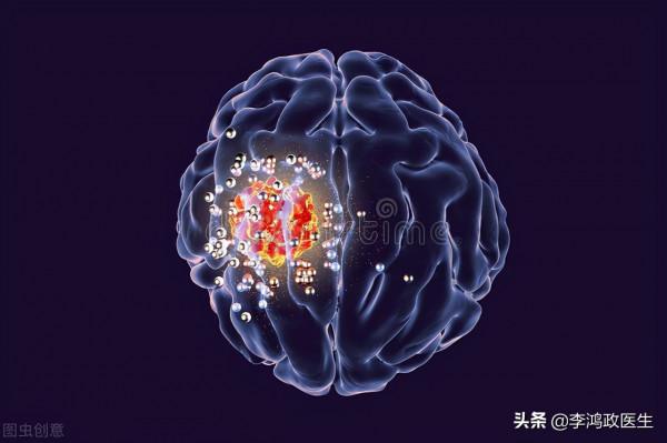男子頭痛以為腦腫瘤,開顱後惡臭液體流出,醫生後背冷汗:誤診了 男子頭痛以為腦腫瘤,開顱後惡臭液體流出,醫生後背冷汗:誤診了