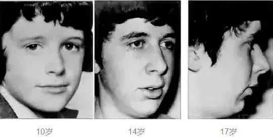 感覺孩子越長越醜,去醫院一查居然是病... 感覺孩子越長越醜,去醫院一查居然是病...