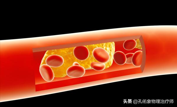 運動是一把雙刃劍！老年人對抗衰老，要注意啥？告訴您幾個建議