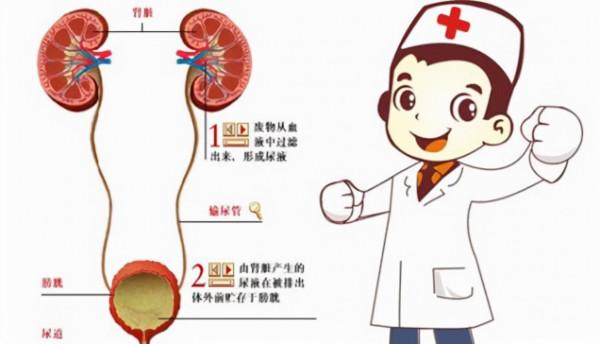 腎結石危害大,預防治療怎麼做?醫生:4種更容易得腎結石 腎結石危害大,預防治療怎麼做?醫生:4種更容易得腎結石