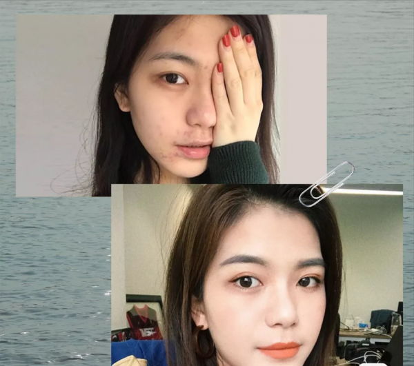 入門級醫美專案指南!美容院不告訴你的,這篇全都有 入門級醫美專案指南!美容院不告訴你的,這篇全都有