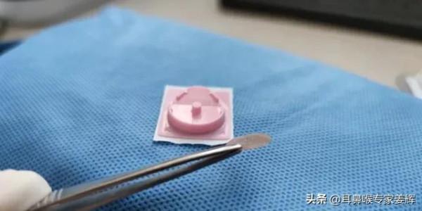 過敏性鼻炎如何用撳(qin)針治療 過敏性鼻炎如何用撳(qin)針治療