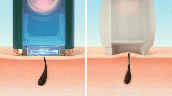 開啟宅家醫美賽道,Ulike連續6年領跑家用脫毛儀類目 開啟宅家醫美賽道,Ulike連續6年領跑家用脫毛儀類目