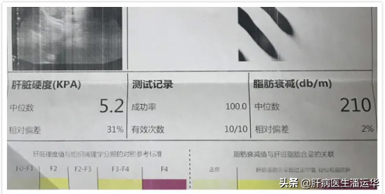 十年乙肝惡化成肝硬化，源頭治療三個月實現逆轉