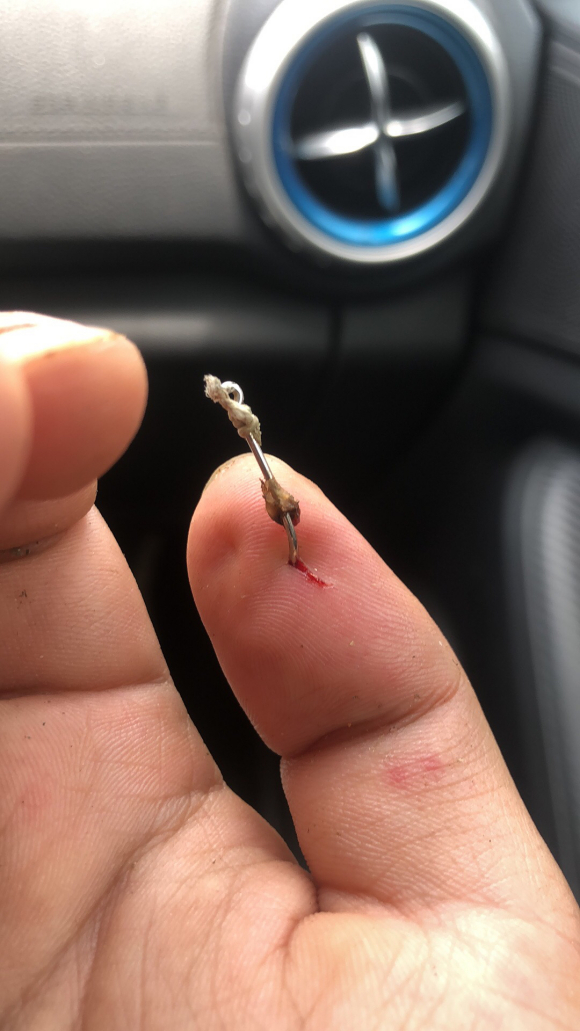 盤點釣魚人各種花式釣自己，看著就很疼！預防和處理方法分享