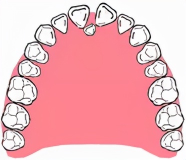 老人突然長新牙,是返老還童?還是患了癌症? 老人突然長新牙,是返老還童?還是患了癌症?