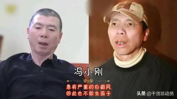 12位隱藏極深的明星身體缺陷,吳京6歲斷指 12位隱藏極深的明星身體缺陷,吳京6歲斷指