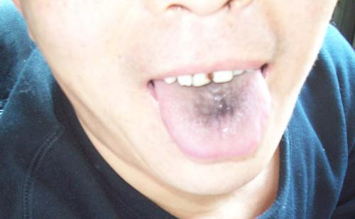 看中醫時大夫讓你“伸舌頭”,到底是在看什麼? 看中醫時大夫讓你“伸舌頭”,到底是在看什麼?