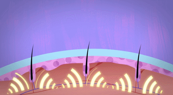 長出來的白髮，還能變黑嗎？中醫、西醫2種方法，“養”出烏髮