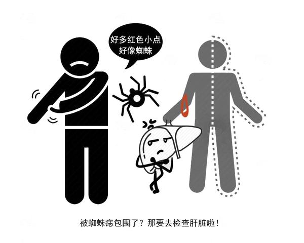 身上的“小紅點”不痛不癢,真的是肝有問題?可能是這4種病 身上的“小紅點”不痛不癢,真的是肝有問題?可能是這4種病