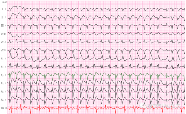 “食道心電圖、食道調搏” 您瞭解嗎? “食道心電圖、食道調搏” 您瞭解嗎?