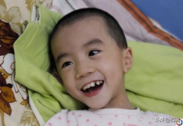 女子懷孕7個月摔跤導致早產，孩子出生僅1.35斤，數次手術求活命