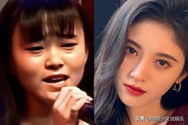 別無效整容了，看看這些曇花一現的女星，整前是仙女，整後變蔡明