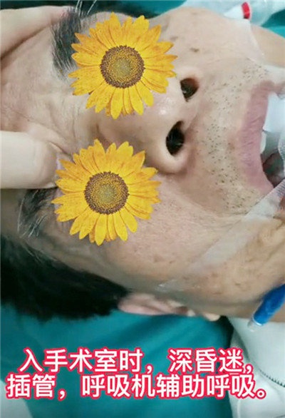 再創生命時速！多科聯動助力卒中患者跑贏&OpenCurlyDoubleQuote;死神&rdquo;